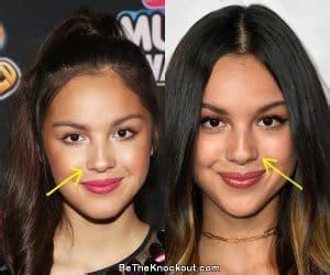 does olivia rodrigo have implants|What is off about olivia rodrigo appearance that。